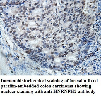 HNRNPH2 Rabbit Polyclonal Antibody