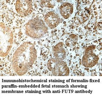 FUT9 Rabbit Polyclonal Antibody