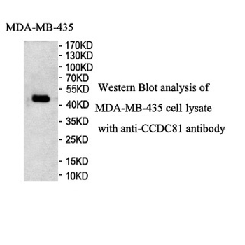 CCDC81 Rabbit Polyclonal Antibody