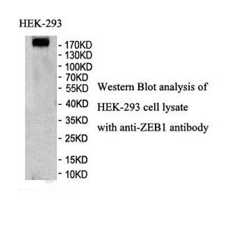 ZEB1 Rabbit Polyclonal Antibody