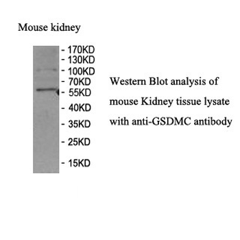 GSDMC Rabbit Polyclonal Antibody