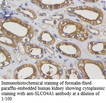 SLCO4A1 Rabbit Polyclonal Antibody