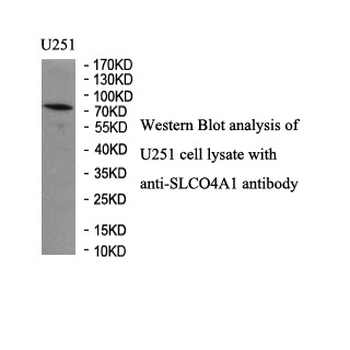 SLCO4A1 Rabbit Polyclonal Antibody
