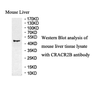 EFCAB4A Rabbit Polyclonal Antibody