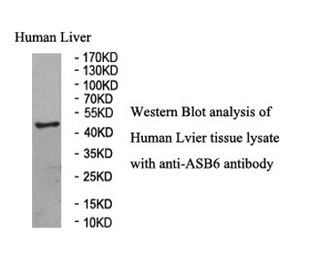 ASB6 Rabbit Polyclonal Antibody