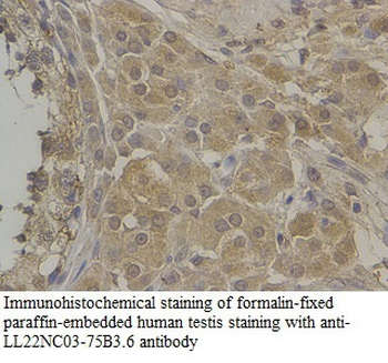 SHISAL1 Rabbit Polyclonal Antibody