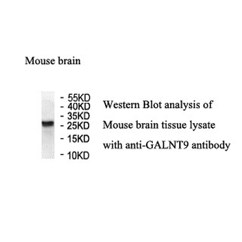 GALNT9 Rabbit Polyclonal Antibody