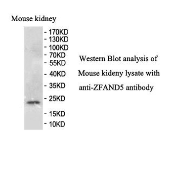 ZFAND5 Rabbit Polyclonal Antibody