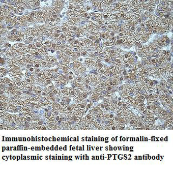 COX2 Rabbit Polyclonal Antibody