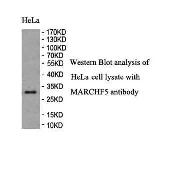 MARCH-V Rabbit Polyclonal Antibody