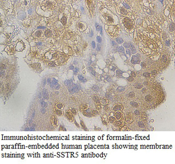 SSTR5 Rabbit Polyclonal Antibody