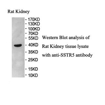 SSTR5 Rabbit Polyclonal Antibody