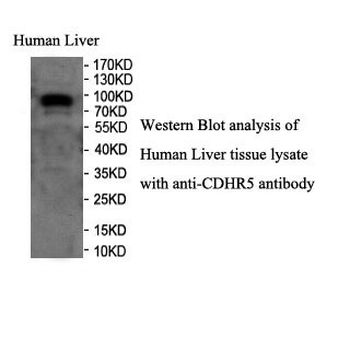 CDHR5 Rabbit Polyclonal Antibody
