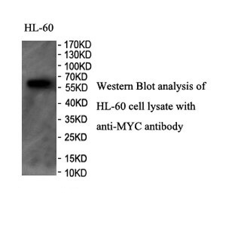 MYC Rabbit Polyclonal Antibody
