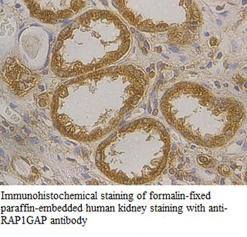 RAP1GAP Rabbit Polyclonal Antibody