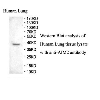 AIM2 Rabbit Polyclonal Antibody