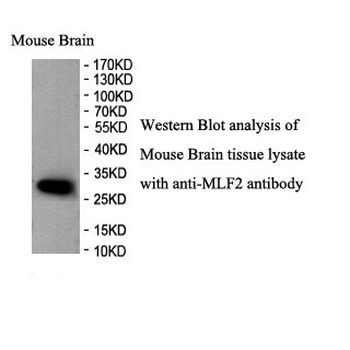 MLF2 Rabbit Polyclonal Antibody