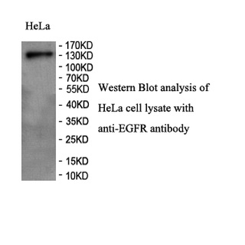 EGFR Rabbit Polyclonal Antibody