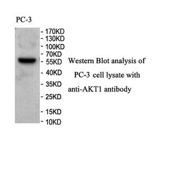 AKT1 Rabbit Polyclonal Antibody