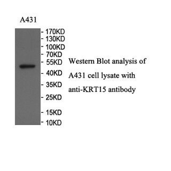 KRT15 Rabbit Polyclonal Antibody
