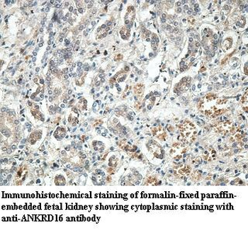 ANKRD16 Rabbit Polyclonal Antibody