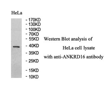 ANKRD16 Rabbit Polyclonal Antibody