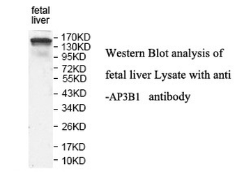 AP3B1 Rabbit Polyclonal Antibody