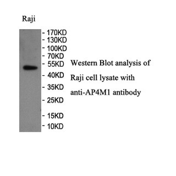 AP4M1 Rabbit Polyclonal Antibody