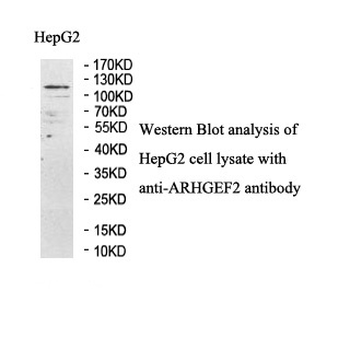 ARHGEF2 Rabbit Polyclonal Antibody
