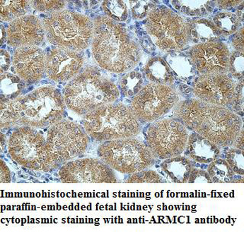 ARMC1 Rabbit Polyclonal Antibody