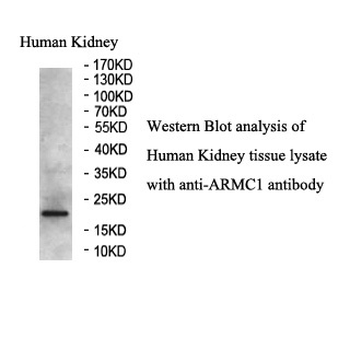 ARMC1 Rabbit Polyclonal Antibody