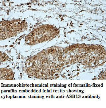 ASB13 Rabbit Polyclonal Antibody