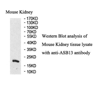 ASB13 Rabbit Polyclonal Antibody