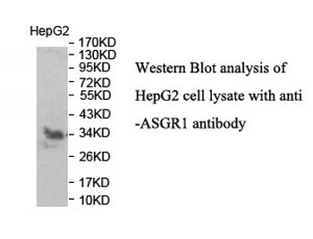 ASGR1 Rabbit Polyclonal Antibody