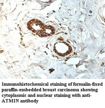 ATMIN Rabbit Polyclonal Antibody