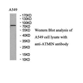 ATMIN Rabbit Polyclonal Antibody