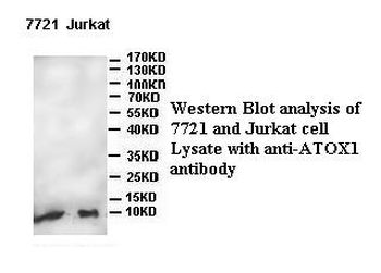 ATOX1 Rabbit Polyclonal Antibody