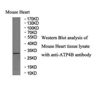 ATP4B Rabbit Polyclonal Antibody