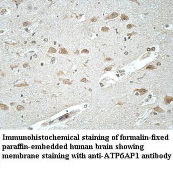 ATP6AP1 Rabbit Polyclonal Antibody