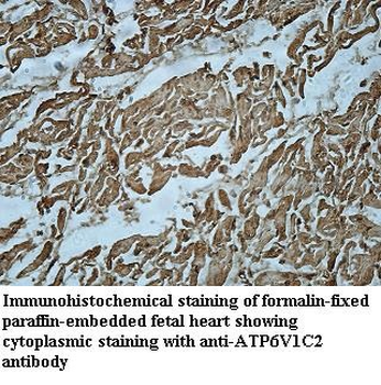 ATP6V1C2 Rabbit Polyclonal Antibody