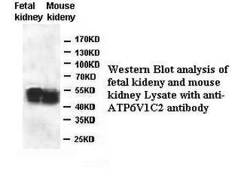 ATP6V1C2 Rabbit Polyclonal Antibody