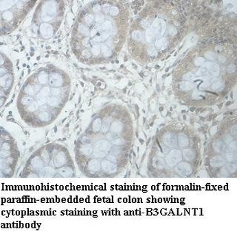 B3GALNT1 Rabbit Polyclonal Antibody