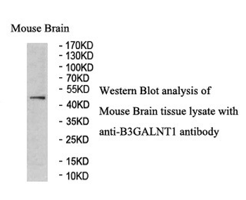 B3GALNT1 Rabbit Polyclonal Antibody