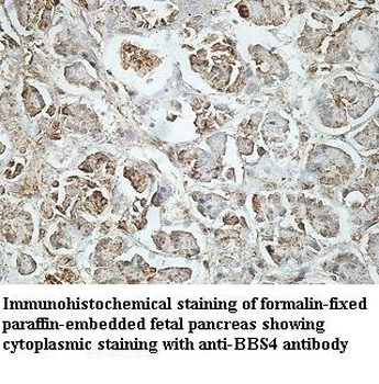 BBS4 Rabbit Polyclonal Antibody
