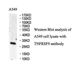 CD137 Rabbit Polyclonal Antibody