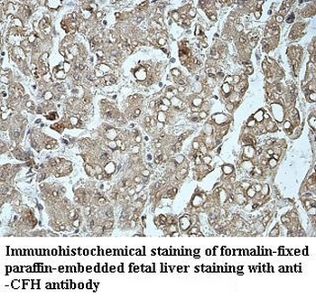 CFH Rabbit Polyclonal Antibody