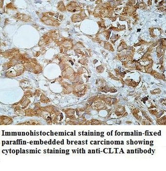 CLTA Rabbit Polyclonal Antibody
