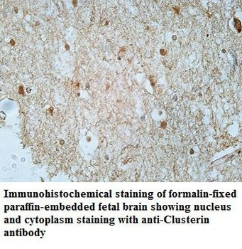 Clusterin Rabbit Polyclonal Antibody