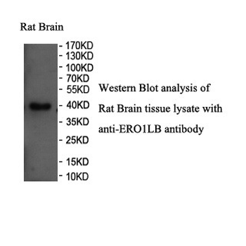 ERO1LB Rabbit Polyclonal Antibody