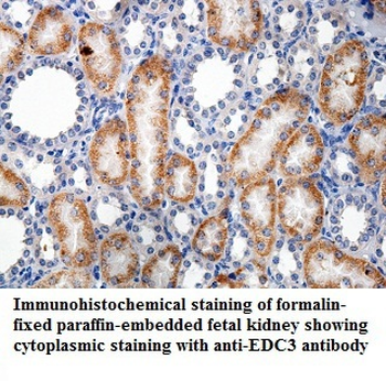 FARSB Rabbit Polyclonal Antibody